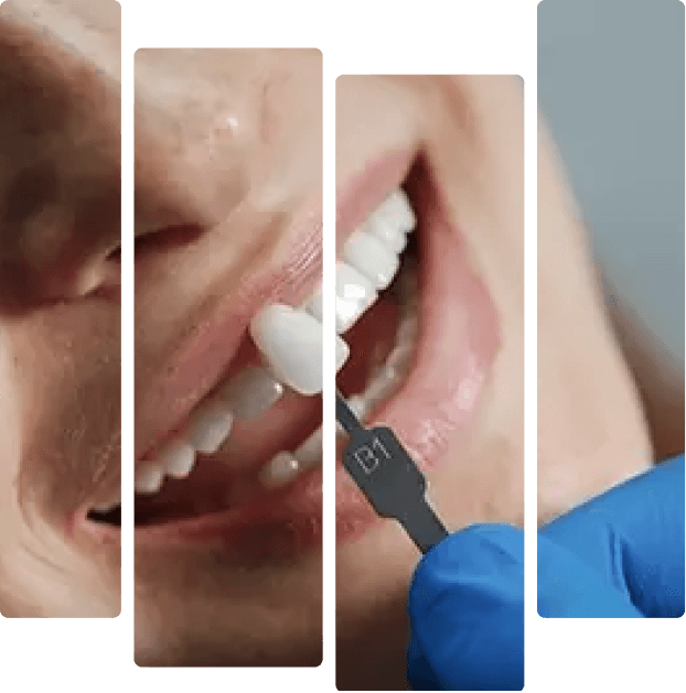 treatment-banner