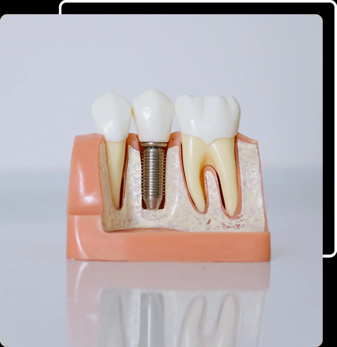 Invisalign® image
