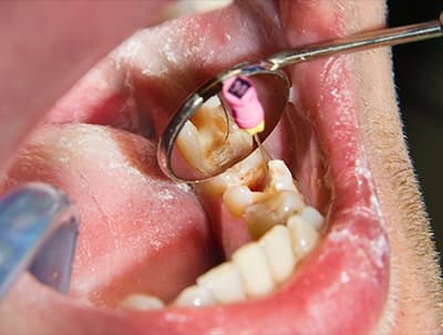 Restorative Dentistry