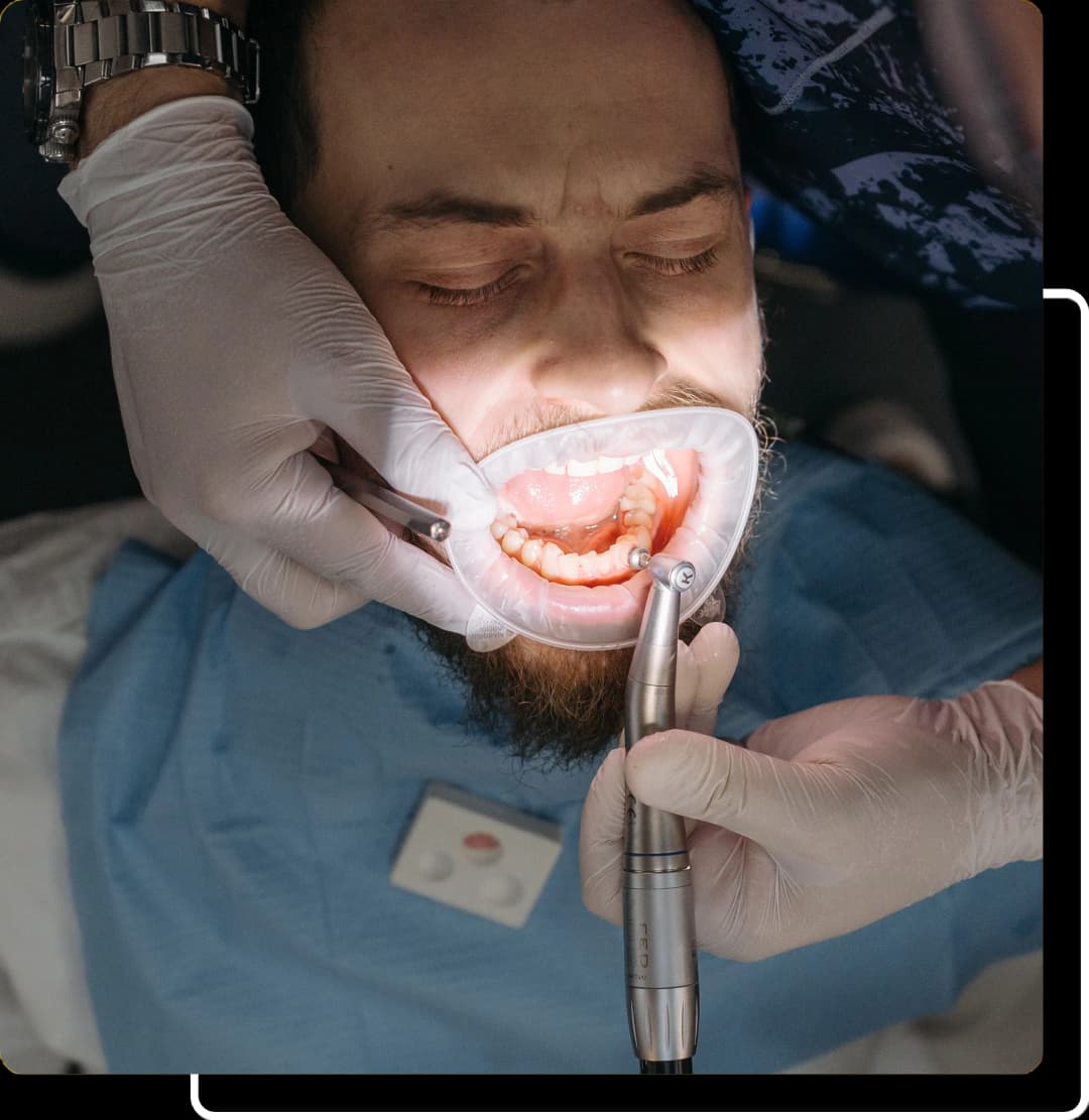 Invisalign® image