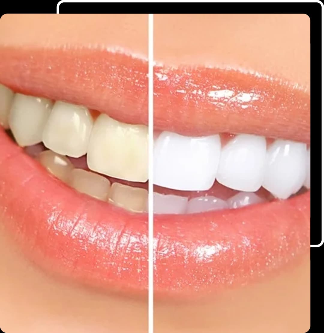 Invisalign® image